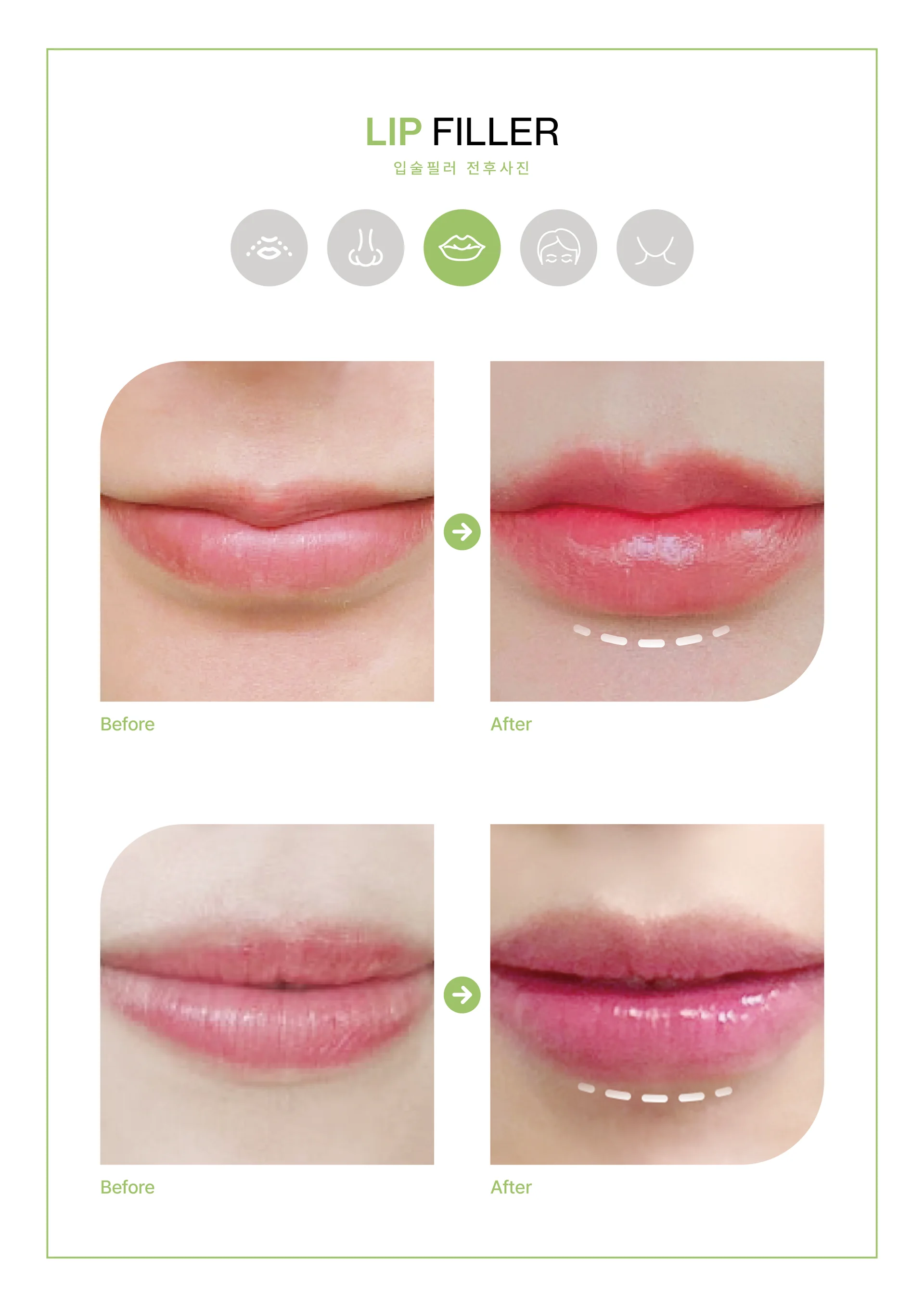 Clinic treatment comparison poster 1