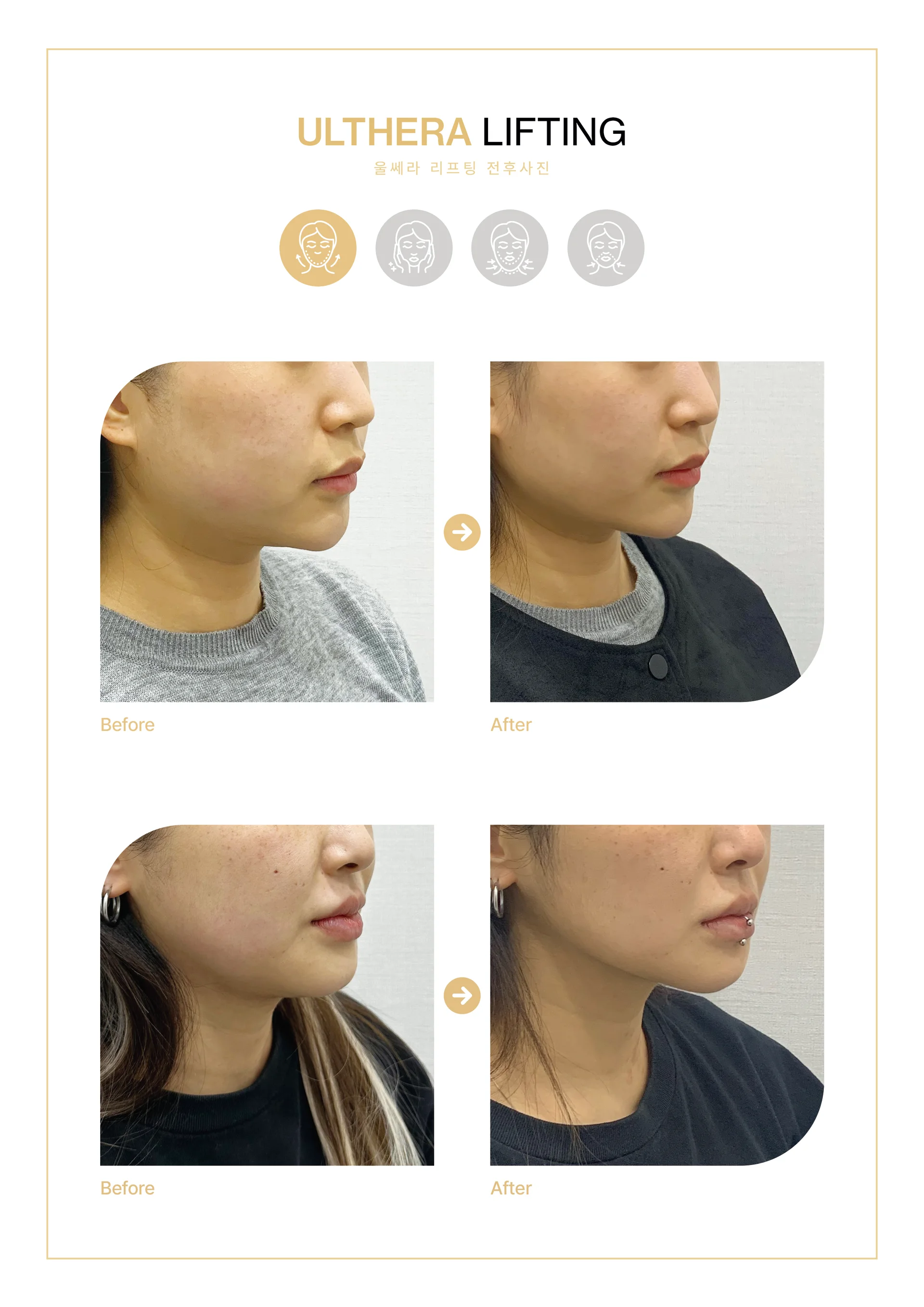 Clinic treatment comparison poster 4