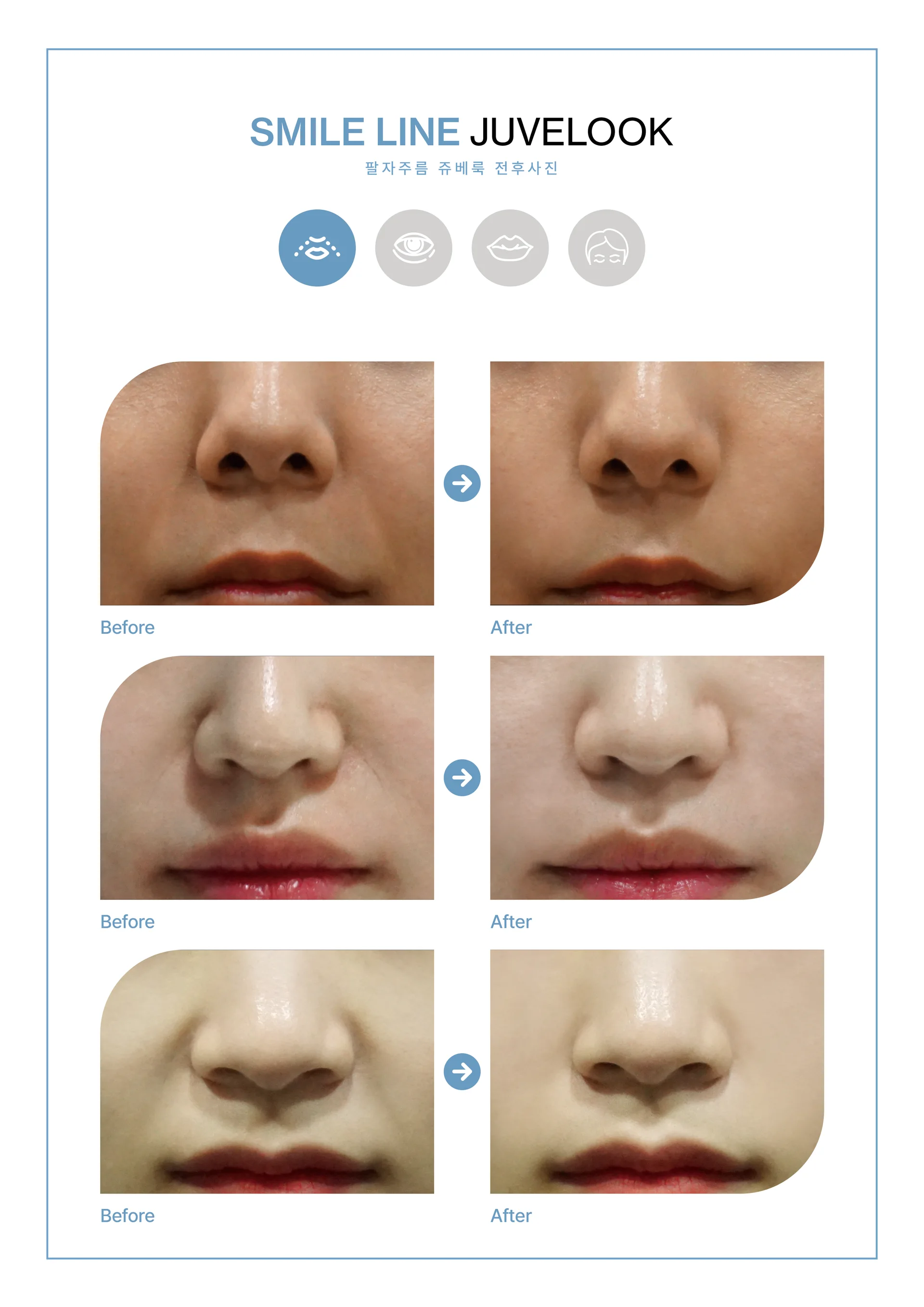 Clinic treatment comparison poster 7